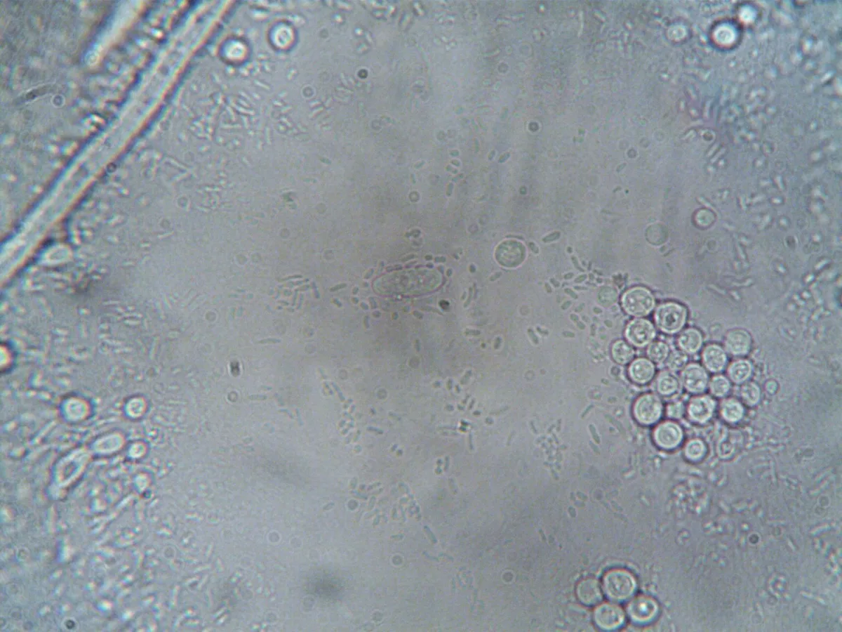 Germ transmission car